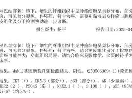 【免疫组化结果已出】想咨询了解一下可能的治疗方案
