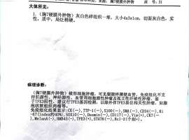 求助疑难! 多年前放疗位置出现软组织肉瘤？肺腺骨转第7年