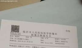 肺鳞癌骨转移