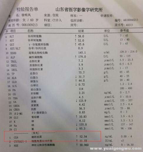 1月前ECA值53