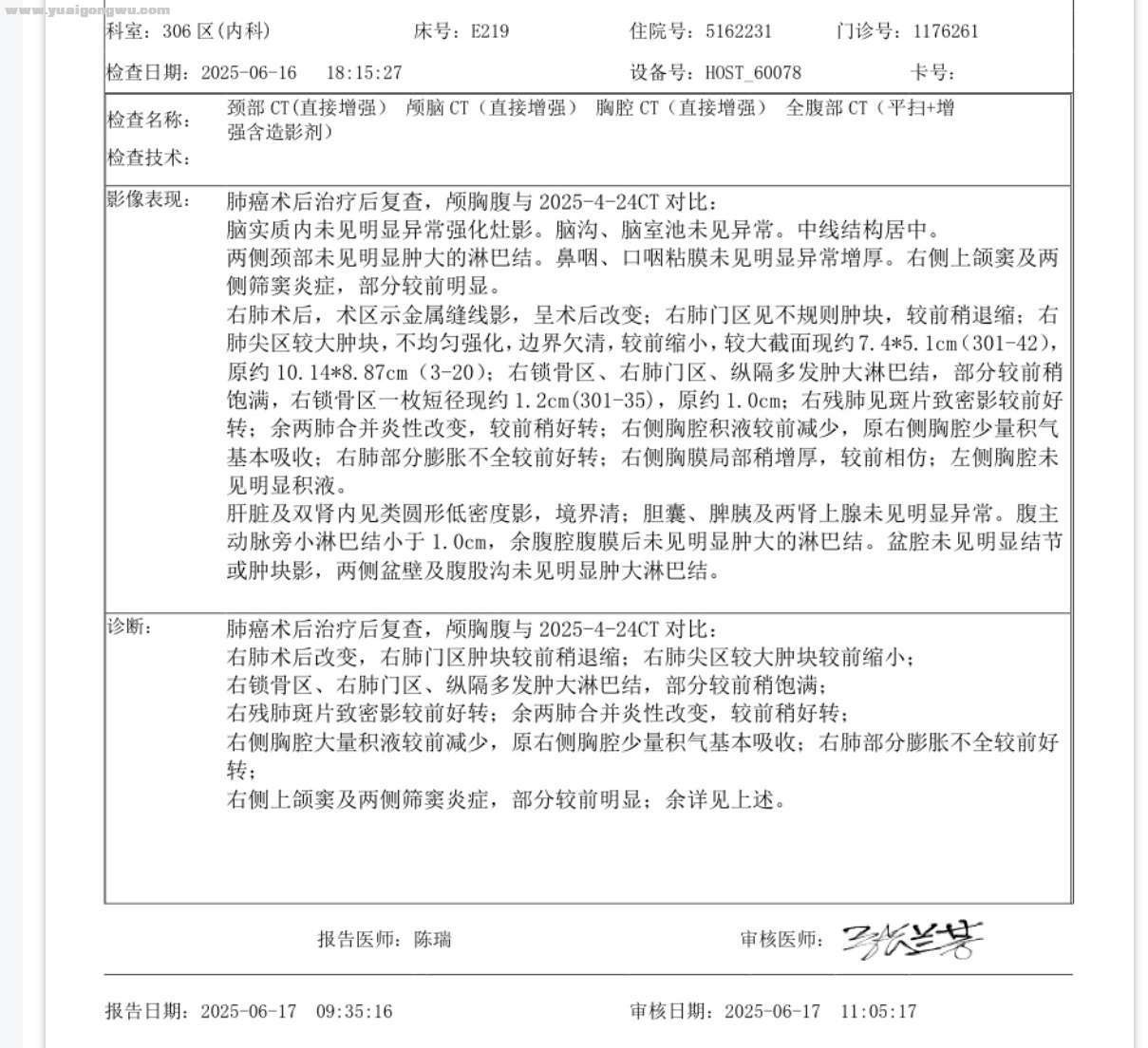 卡度联合安罗，谁让肿瘤缩小了